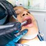 wykonywanie zabiegu dentystycznego