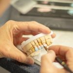 Technik dentystyczny precyzyjnie dopasowuje koronę na modelu gipsowym zębów