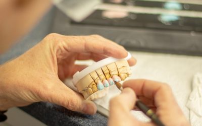 Technik dentystyczny precyzyjnie dopasowuje koronę na modelu gipsowym zębów