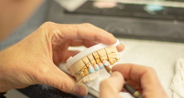 Technik dentystyczny precyzyjnie dopasowuje koronę na modelu gipsowym zębów